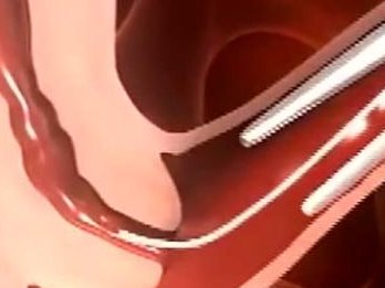 高龄女性去美国做试管婴儿成功率高吗？影响美国高龄试管成功率的因素有哪些？美国高龄女性试管婴儿多少钱？