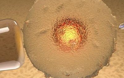 俄罗斯试管全过程是怎么样的？附俄罗斯试管婴儿流程分享